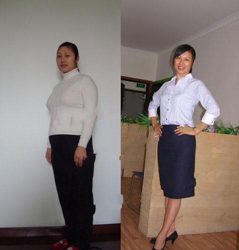 高二同学都组团割双眼皮了,那整形的年龄到底是多少_BJL平台集团(图3) BJL平台集团